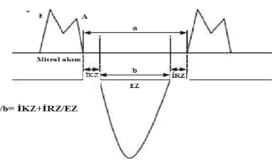 Şekil 3: Doppler yöntemiyle zaman intervallerinin ölçümü ve konvansiyonel metotla MPİ  hesaplanması