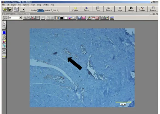 Şekil 2.4. Clemex Vision Lite 3.5 görüntü analizi sistemi ile kalp örnekleri için 20’lik  büyütmedeki  alanın  hesaplanması  ve  MT  boyanmış  miyositlerin  işaretlenerek  saydırılması