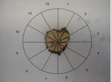 Şekil 5. Kesitin 12  zona  bölünmüş çember şeklindeki slayt  üzerinde şematize edilmiş  görünüşü (Saat 4-5