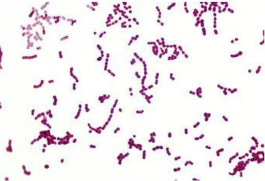 Şekil  2.8.  Lactococcus  lactis  ssp.  lactis’in  Gram  boyama  yöntemiyle  boyanmış  görüntüsü 
