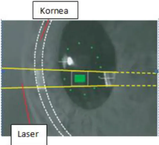 Şekil 4. Laser flaremetre grafik ve liste ölçüm sonucu 