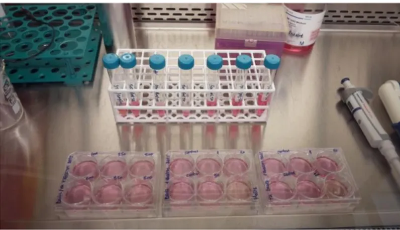 Şekil  3.7.2.  Trypan  blue  metodu  için  6  kuyucuklu  plakalara  ekilen  HEPG2  hücrelerinin  48  saat  inkübasyonu sonrası EHTA ekstraktı ile muamelesi 