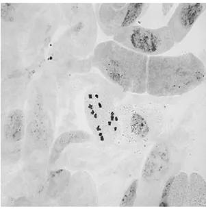 Şekil  4.1.  Scorzonera  laciniata  subsp.  laciniata  taksonunun  metafaz  kromozomları  2n=14 (bar: 5 µm).