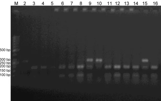 Şekil 4.3. Kontrol grubundaki bireylerde ERCC6 gen polimorfizminin %2’lik agaroz jel  görüntüsü