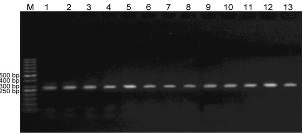 Şekil 4.5. GSTM3 gen bölgesinde kontrol grubundaki bireylerin PZR ürünlerin %4’lük  agaroz jel görüntüsü