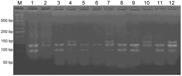 Şekil 4.8. Dental materyalli bireylerde GSTM3 gen polimorfizminin %4’lük agaroz jel  görüntüsü