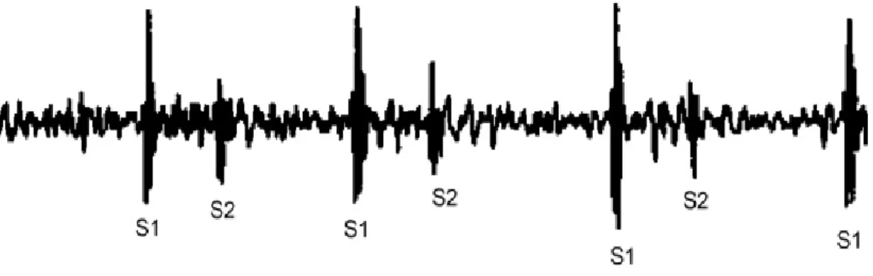 Şekil 3.10. S1 ve S2 normal kalp sesleri (Phua ve ark., 2008) 