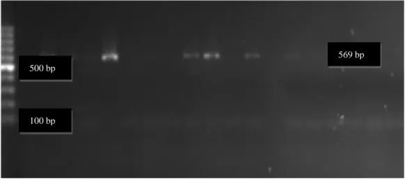 Şekil  3.2.  Lactobacillus  iners’e  ait  PCR  sonuçlarının  Gel  Logic  200  Imaging  System  görüntüsü (çalışmamızdan)