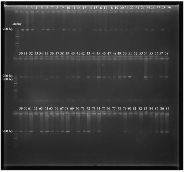 ġekil 4.2. S. aureus suşlarındaki spa-IgG gen bölgesinin PCR Ürünlerinin agaroz jel elektroforezi  (Marker: 50 bç) 