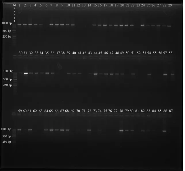 ġekil 4.3. S. aureus suşlarındaki clfA gen bölgesinin PCR Ürünlerinin agaroz jel elektroforezi (Marker:  50 bç) 