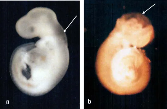 Çizelge 3.1. Dimenhidrinat  (2,5g /ml, 5g /ml, 10g /ml, 15g /ml ve 20g /ml)  ile 48 saat kültüre edilen 11,5 günlük rat embriyolarında inkübasyon sonrası saptanan  anomalilerin tipleri ve sıklıkları