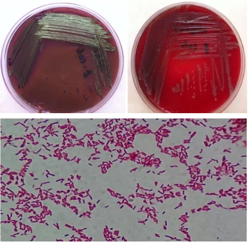 Şekil  2.1.  Escherichia  coli‟nin  EMB  agar  ve  kanlı  agar  besiyerlerlerindeki ve gram boyama görüntüleri
