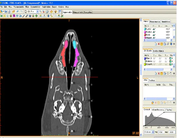 ġekil  2.4.  Coronal  kesit  üzerinde  sağ  ve  sol  taraftaki  concha  nasalis  ventralis’in  sınırlarının farklı renklerle sınırlandırılması