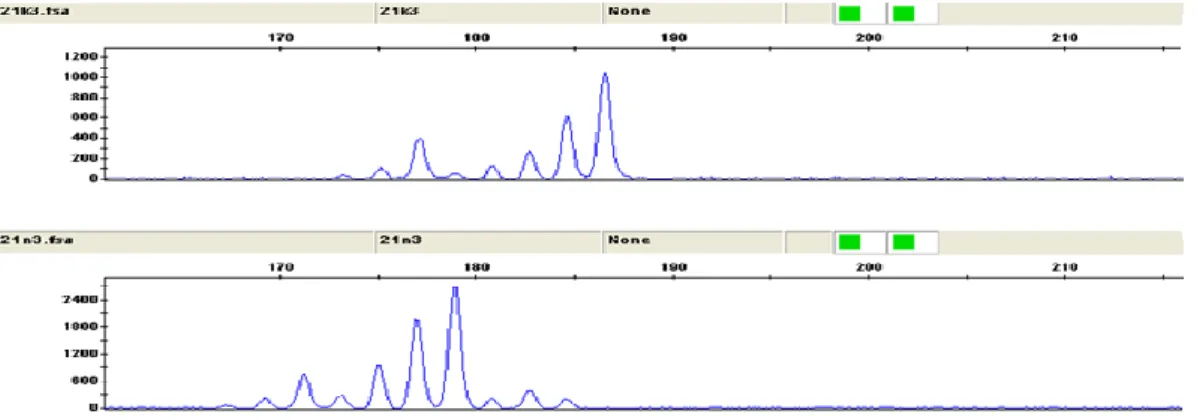 Şekil 3.10. 45 no’lu hastada D8S261’de normal heterozigot 