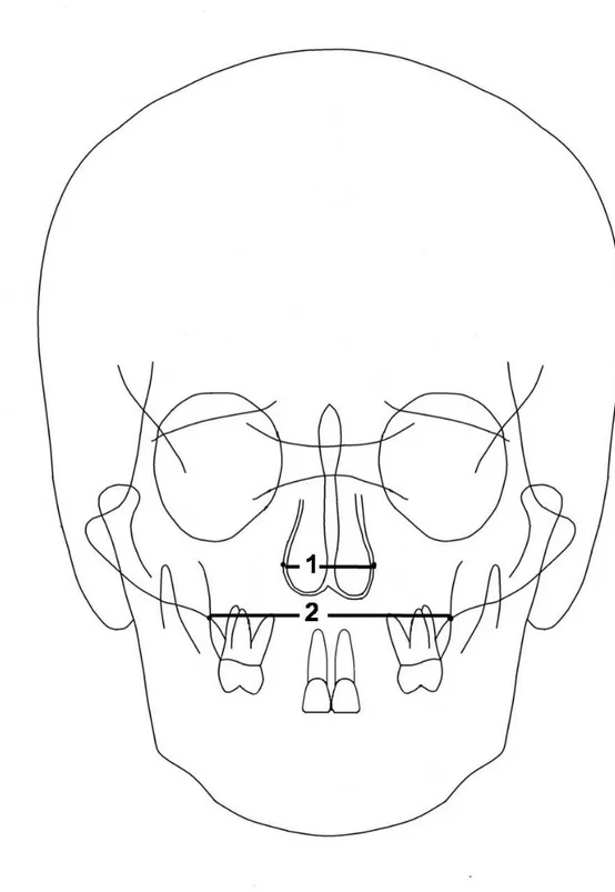 Şekil 2.7. Frontal sefalometrik radyografilerde yapılan ölçümler 