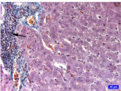 Şekil 8. Aflatoksin+glukomannan grubunda karaciğerin portal alanlarında görülen mononükleer hücre  infiltrasyonları (ok), üçlü boyama