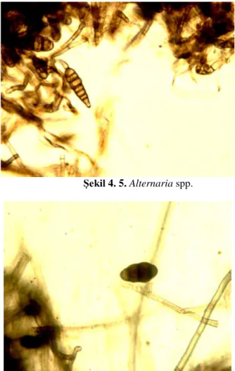 Şekil 4.6 . Alternaria spp. konidi 