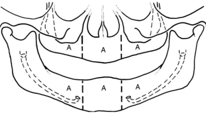 ġekil 1.2. Tip 1 divizyon A ark (Misch 2005). 