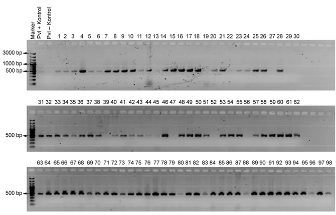 Şekil 4.1.  S. aureus suşlarında PVL gen bölgesinin PCR ürünlerinin agaroz jel elektroforezi 