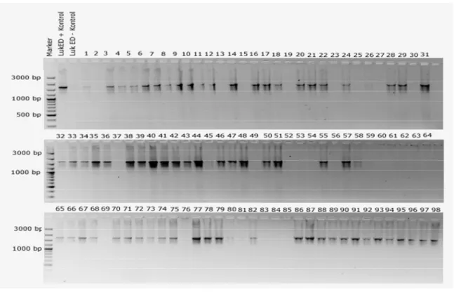 Şekil 4.3.  S. aureus suşlarında LukED gen bölgesinin PCR ürünlerinin agaroz jel elektroforezi 