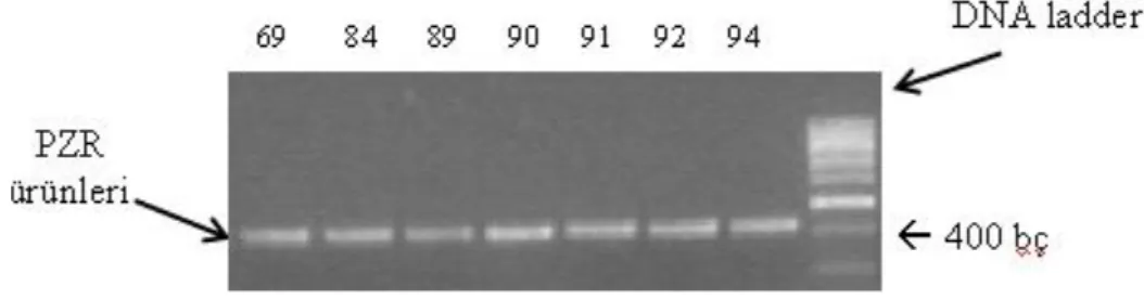 ġekil 3.1. DGAT1 geninin 10230 – 10644 nükleotidleri arasıdaki bölgesinin PZR ürününün, agaroz  jel fotoğrafı
