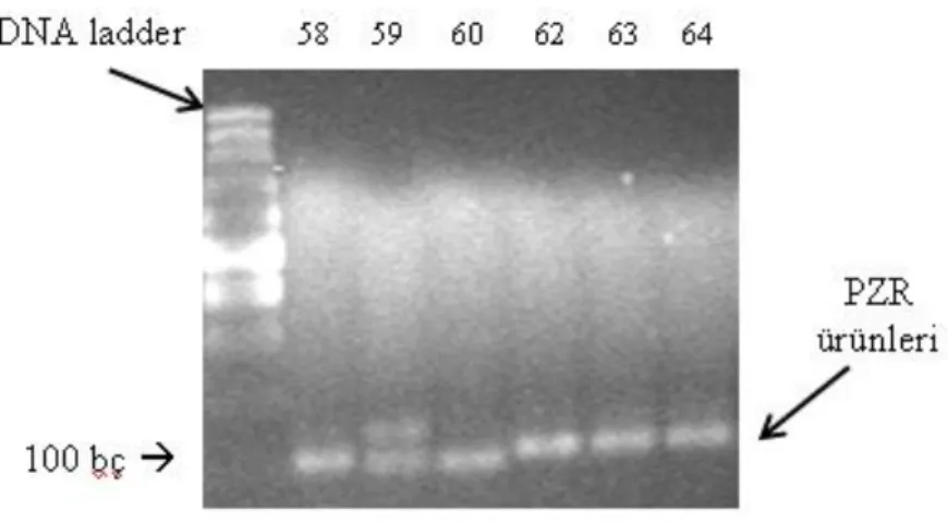 ġekil  3.3.  PRNP  geninin  49686  –  49776  (intron  1)  nükleotidleri  arasında  bulanan  bölgesinin  PZR  ürününün, agaroz jel fotoğrafı