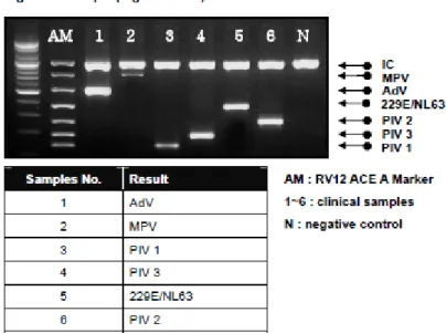 Şekil 3. Kit prospektüsünden alınmış agaroz jelde yürüyen virusların görüntüsü (A marker)  