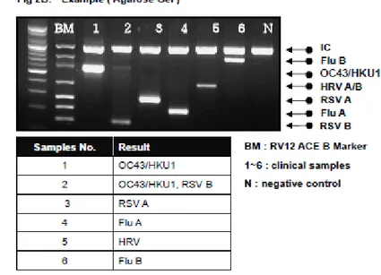 Şekil 3. Kit prospektüsünden alınmış agaroz jelde yürüyen virusların görüntüsü (B Marker) 