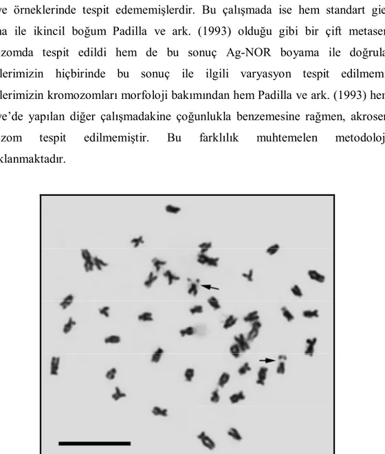 Şekil 4.1. Beyşehir Gölü’ndeki 1 nolu Tinca tinca örneğinin metafaz plağı. Oklar ikincil boğumların  pozisyonunu göstermektedir