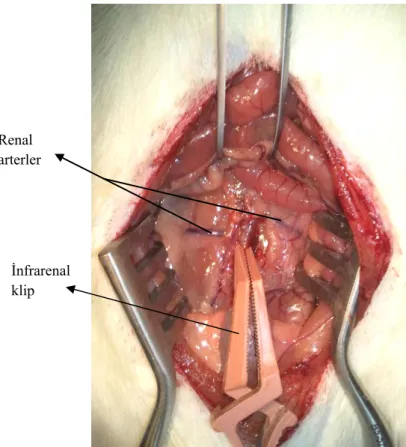 Şekil 2.1: Abdominal aortaya ifrarenal bölgeden klip yerleştirilmesi. 