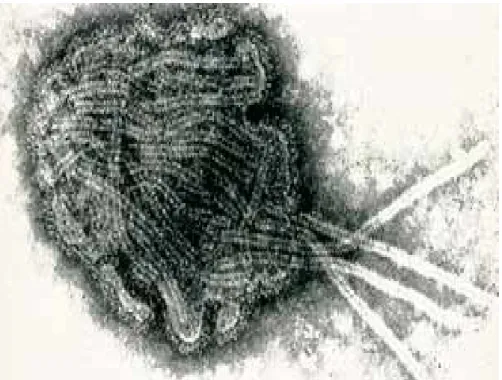 Şekil 1.1. Morbillivirus’un elektron mikroskobik görüntüsü              (Di Sciara 2002)