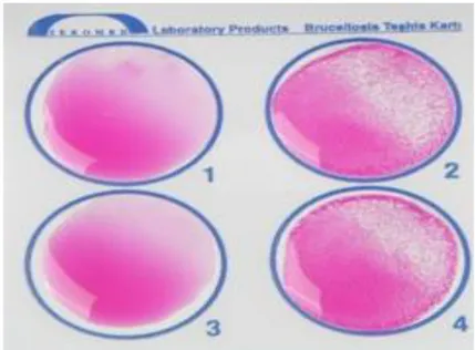 Şekil 3.5.  Brucella Rose Bergal Plate Test Pozitif ve Negatif örneği 