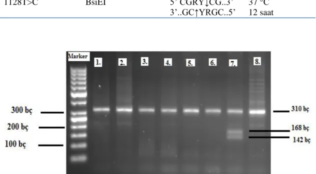 Şekil 2.2. RFLP yöntemi ile elde edilen NPY genine ait 1128T&gt;C genotipleri. 