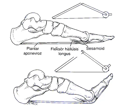 Şekil 6.  Çıkrık mekanizmasının plantar fasianın orijininde tansiyona neden olması.  