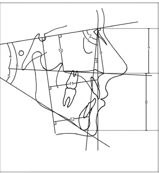 Şekil 2.3. Lateral sefalometrik radyograflarda yapılan iskeletsel ölçümler. 