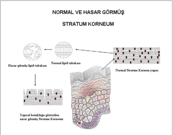 Şekil 4.2 Normal ve hasar görmüş stratum korneum 