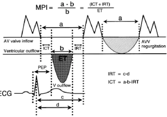 Şekil 1: Pulsed Doppler yöntemi ile MPİ ölçümü ve EKG’ye uyarlanışı  