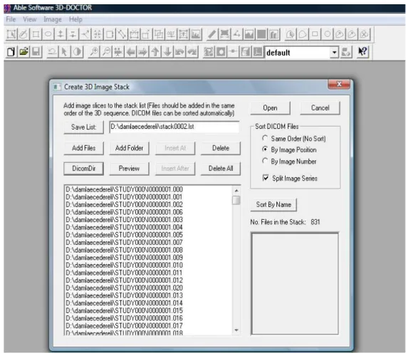 ġekil 12. DICOM Formatındaki Görüntünün KiĢisel Bilgisayara Transferi 