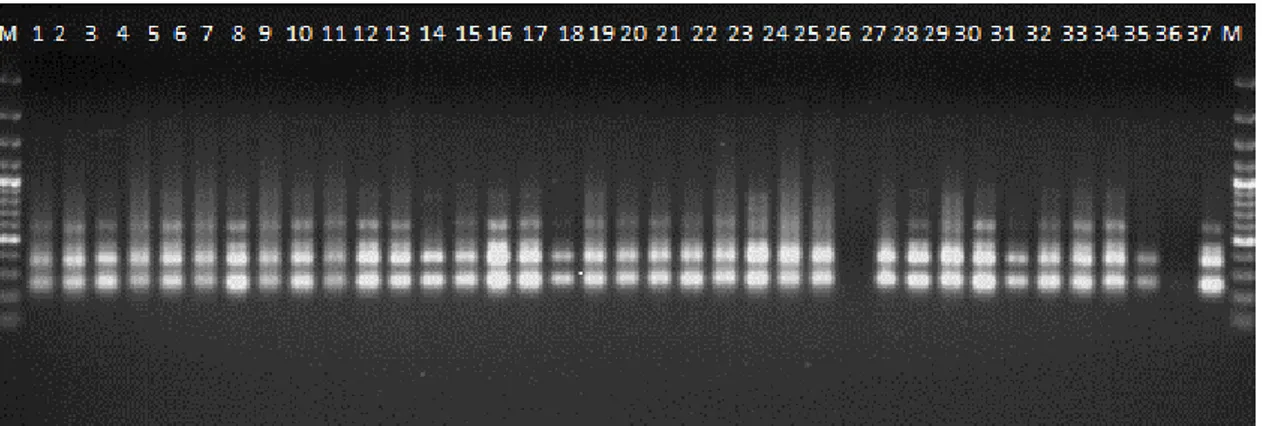 Şekil 3.2.2.7.2. F5 Primerinin Bulk-1 için  DNA jel görüntüsü 