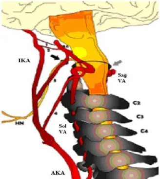 Şekil 3: Karotid vertebrobaziller anastomozlar. 1. Trigeminal arter, 2. Otik arter, 3