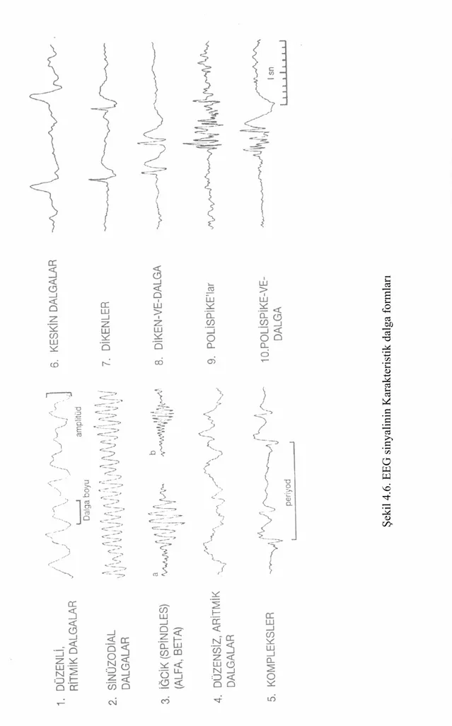 Şekil 4.6. EEG sinyalinin Karakteristik dalga formları 