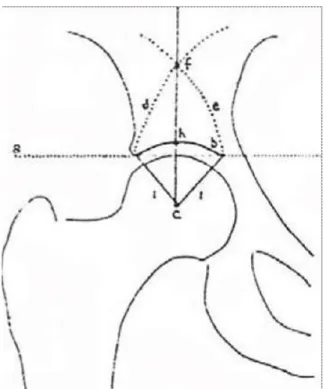 Şekil 16. (a) yük taşıma yüzeyinin yatay düzlemdeki konumu, (b) asetabuler  subkondral yoğunlaşma, (c) femur başının rotasyon merkezi, (d) iliumda lateral arkı 