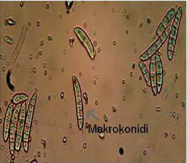 Şekil 4.12 Fusarium culmorum’un Makro Konidileri