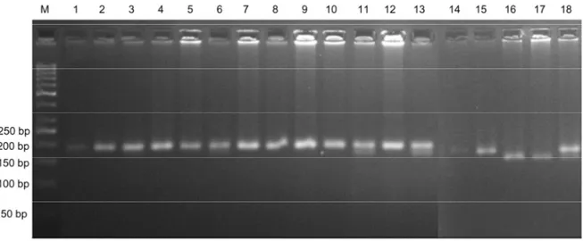 Şekil 4.3. Hasta grubu örneklerinde MTHFR C677T gen polimorfizminin %2.5’lük agaroz jel görüntüsü                 [1-5, 7-10, 12, 14-15: C/C (198 bç)],  [6,11,13,18: C/T (198,175,23 bç)],  [16-17: T/T (175 bç)]