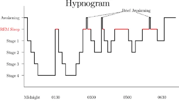 Şekil 2.10 Hipnogram örneği (Oxford Tıp dergisi 2007.) 