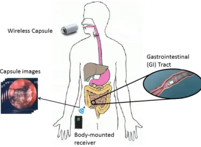 Figure 1. General overview of a wireless capsule endoscopy system 