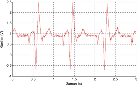 Şekil 11. Bilgisayarda görüntülenen EKG sinyalinin matlab programına aktarılmış hali 