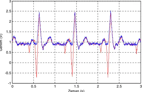 Şekil 12. İletim öncesi ve optik iletim sonrası görüntülenen EKG sinyallerinin birlikte  görüntülenmesi 