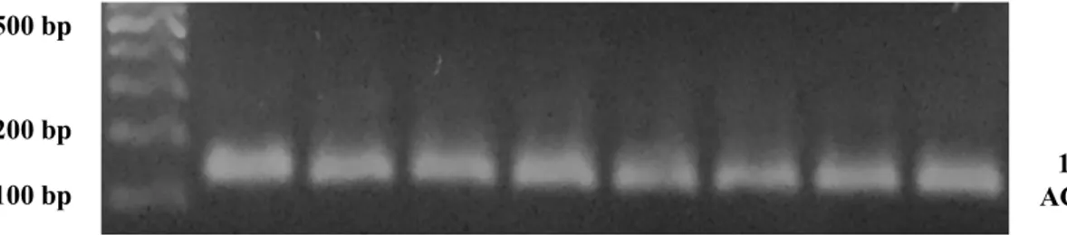 ġekil  2.3. cDNA‟ların ACTB primerleri ile  yapılan PZR ürünlerinin %2‟lik agaroz  jel görüntüsü