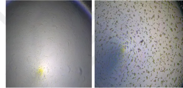 Şekil  4.1.  HSV-1  ile  enfekte  olmamış  (solda)  ve  enfekte  olmuş  (sağda)  Vero  hücrelerinin görünümü (Orijinal) 